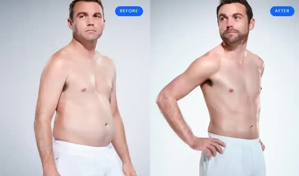 Side-by-side male torso transformation: before and after weight loss, wearing white shorts on a light background