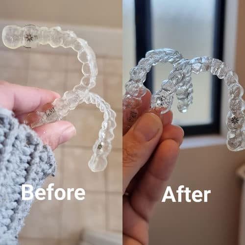 A side-by-side comparison of clear dental aligners, labeled 