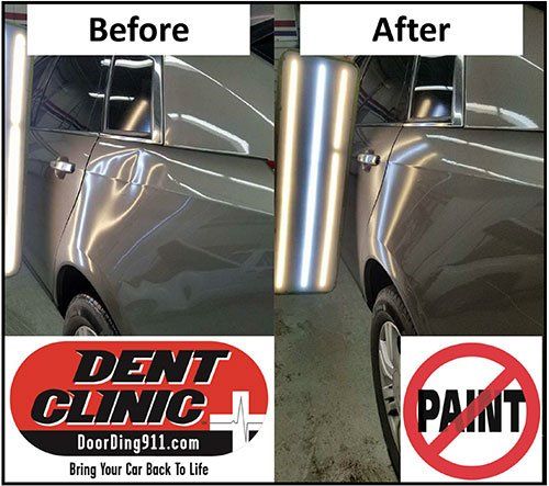 Paintless Dent Repair | Dent Clinic