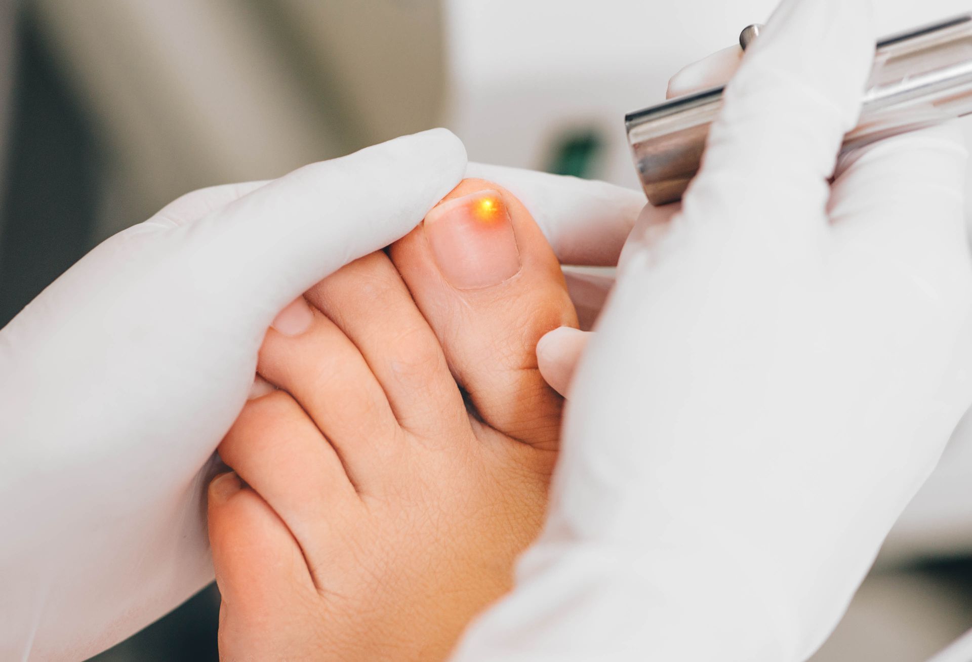 A gloved professional uses a laser device on a patient’s toenail during a clinical procedure.