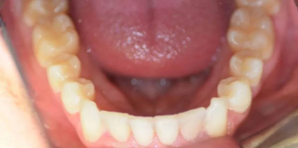 Open mouth with lower teeth visible. The teeth are yellowish with a pink mouth and tongue.