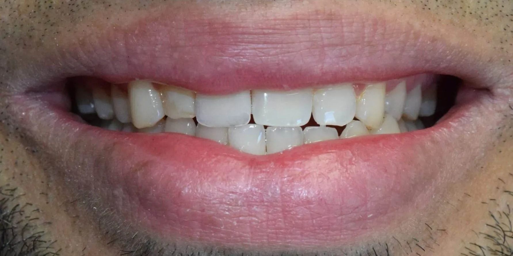 Close-up of a person's smiling mouth showing teeth and lips.
