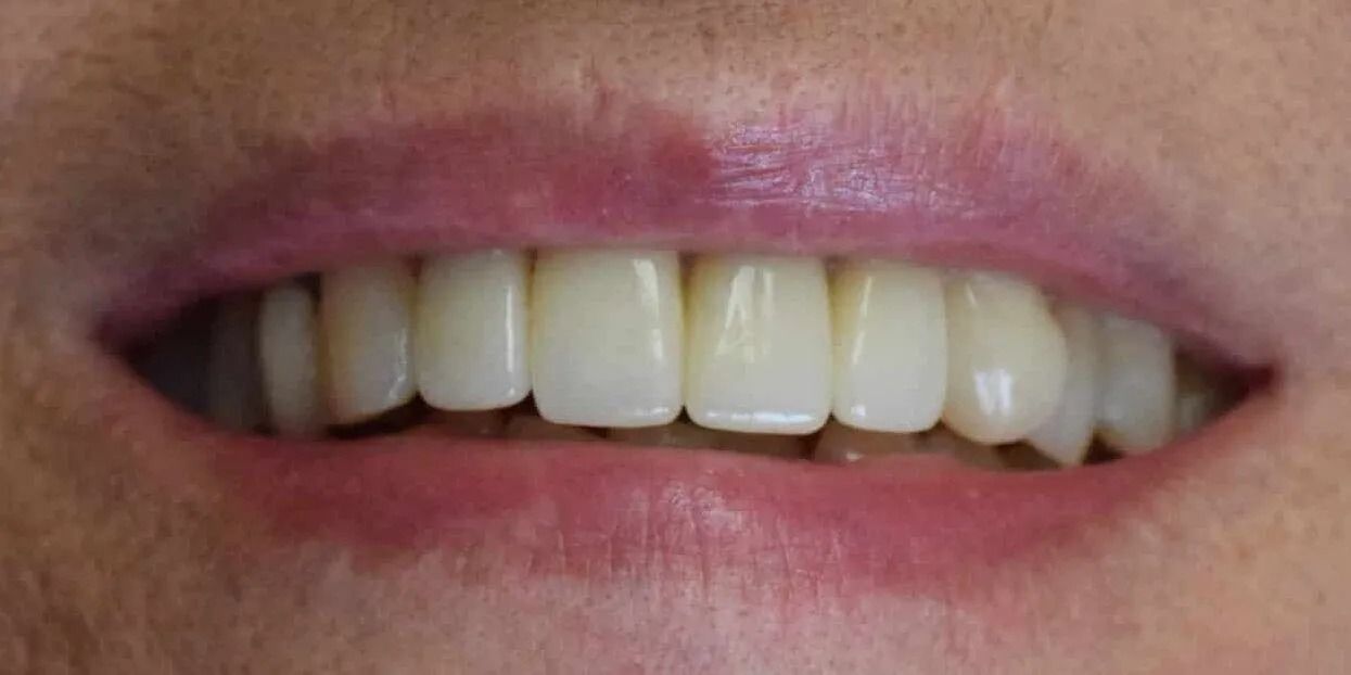 Close-up of a person's smiling mouth showing straight, white teeth and pink lips.