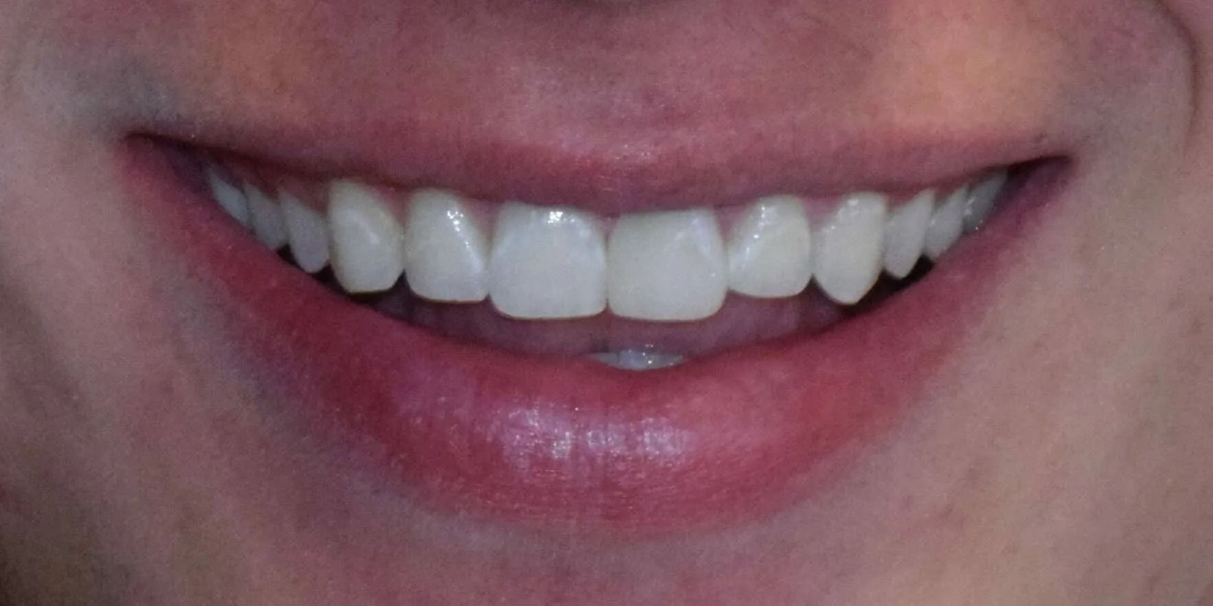 Close-up of a smiling mouth with bright white teeth and red lips.