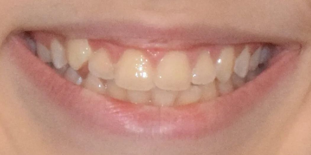 Close-up of a person's smiling mouth showing teeth and pink lips.