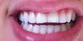 Close-up of a smiling mouth with white teeth and pink lips.