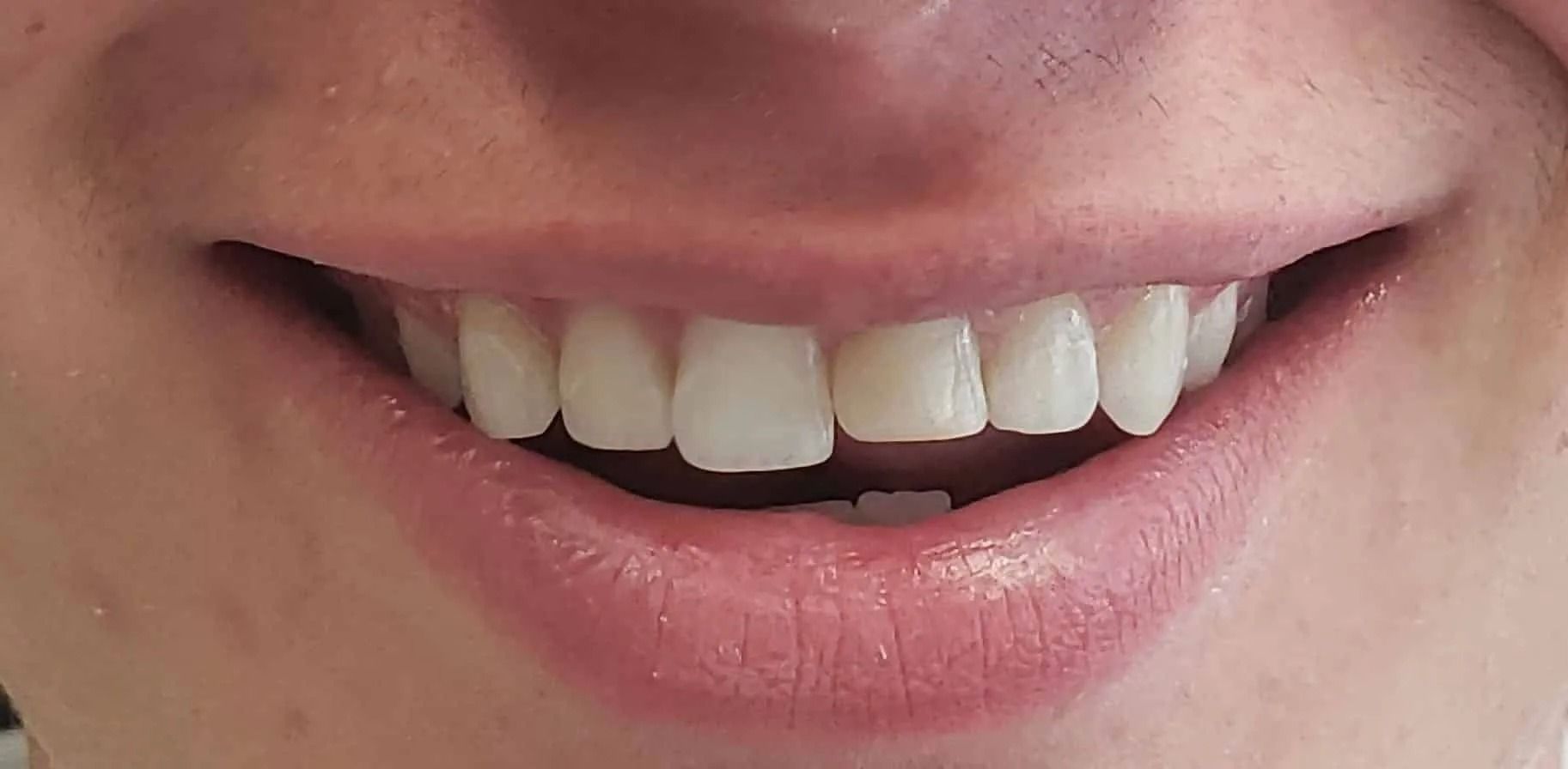 A person smiling, showing white teeth. The lips are closed at the sides.
