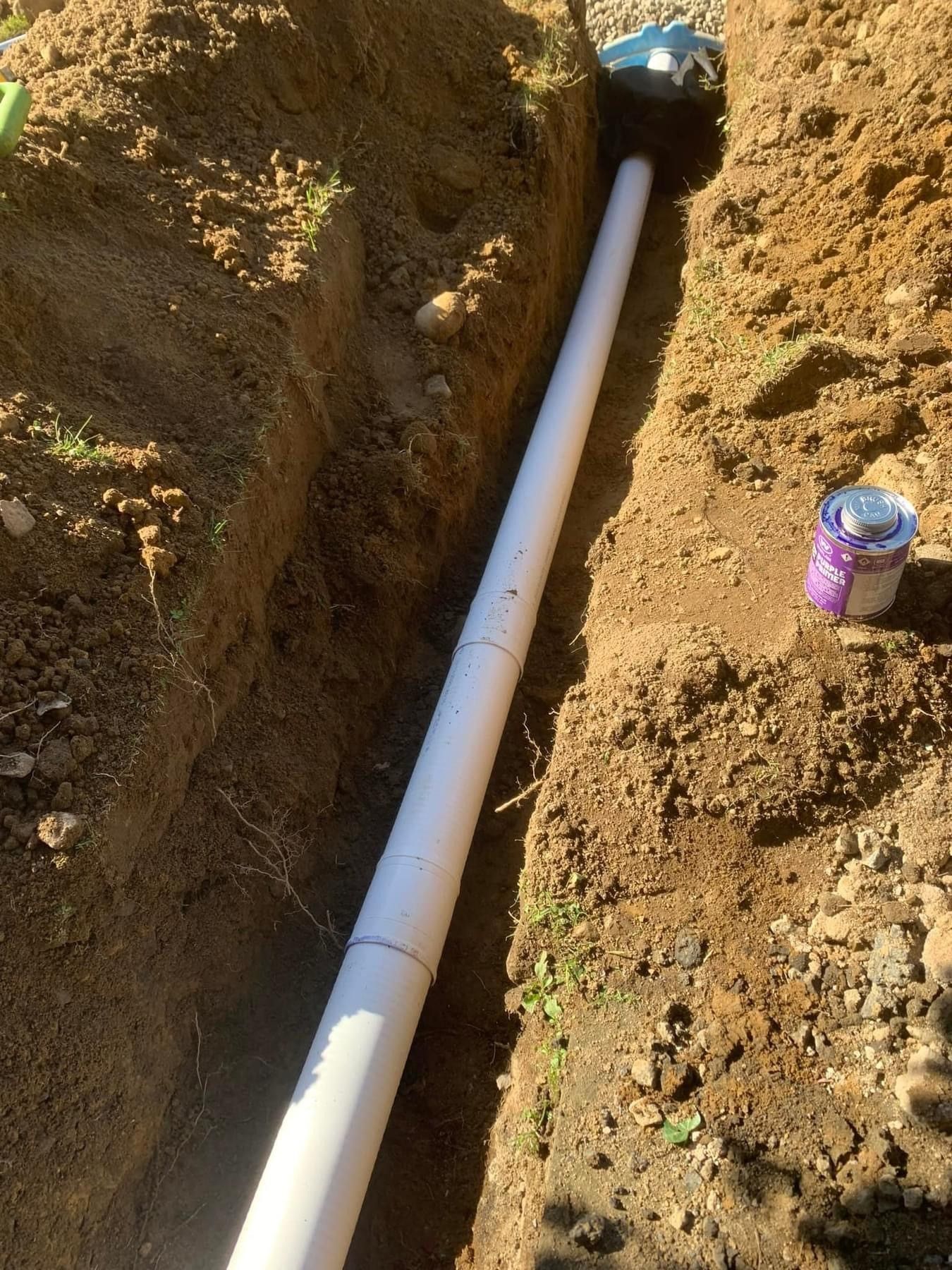 drainage tube