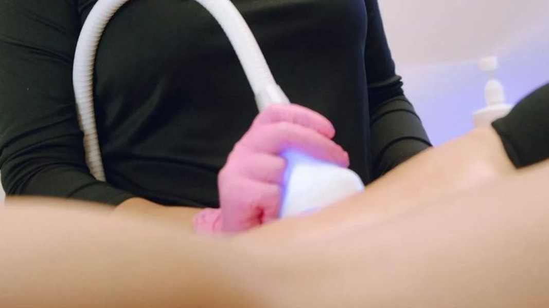 Ultra Cryo & Recovery