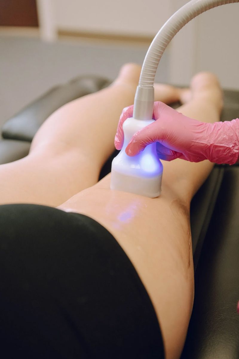 A person receiving a body contouring treatment. A gloved hand holds a device emitting blue light on a thigh.