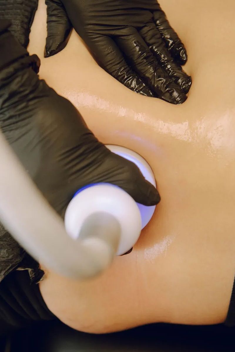 Person receiving body sculpting treatment on lower back; technician using a handheld device.