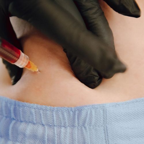 A gloved hand injecting a needle into the abdomen of a person wearing blue pants. Blood fills the syringe.
