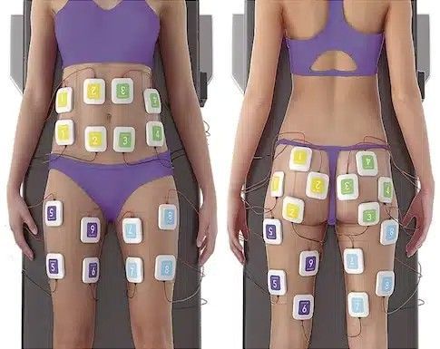 Two women in purple underwear with electrodes attached to their bodies for muscle stimulation