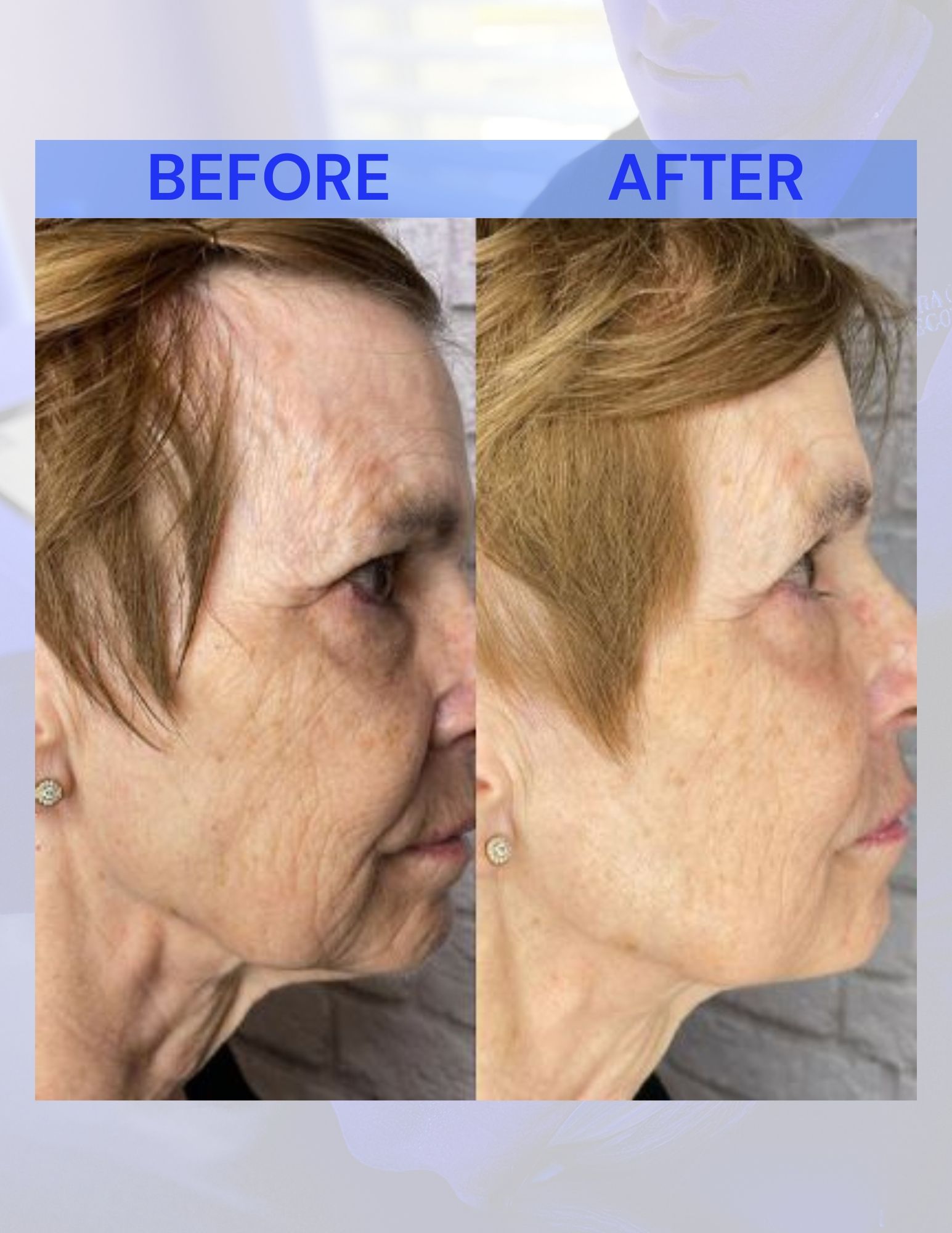 A before and after photo of a woman's face.