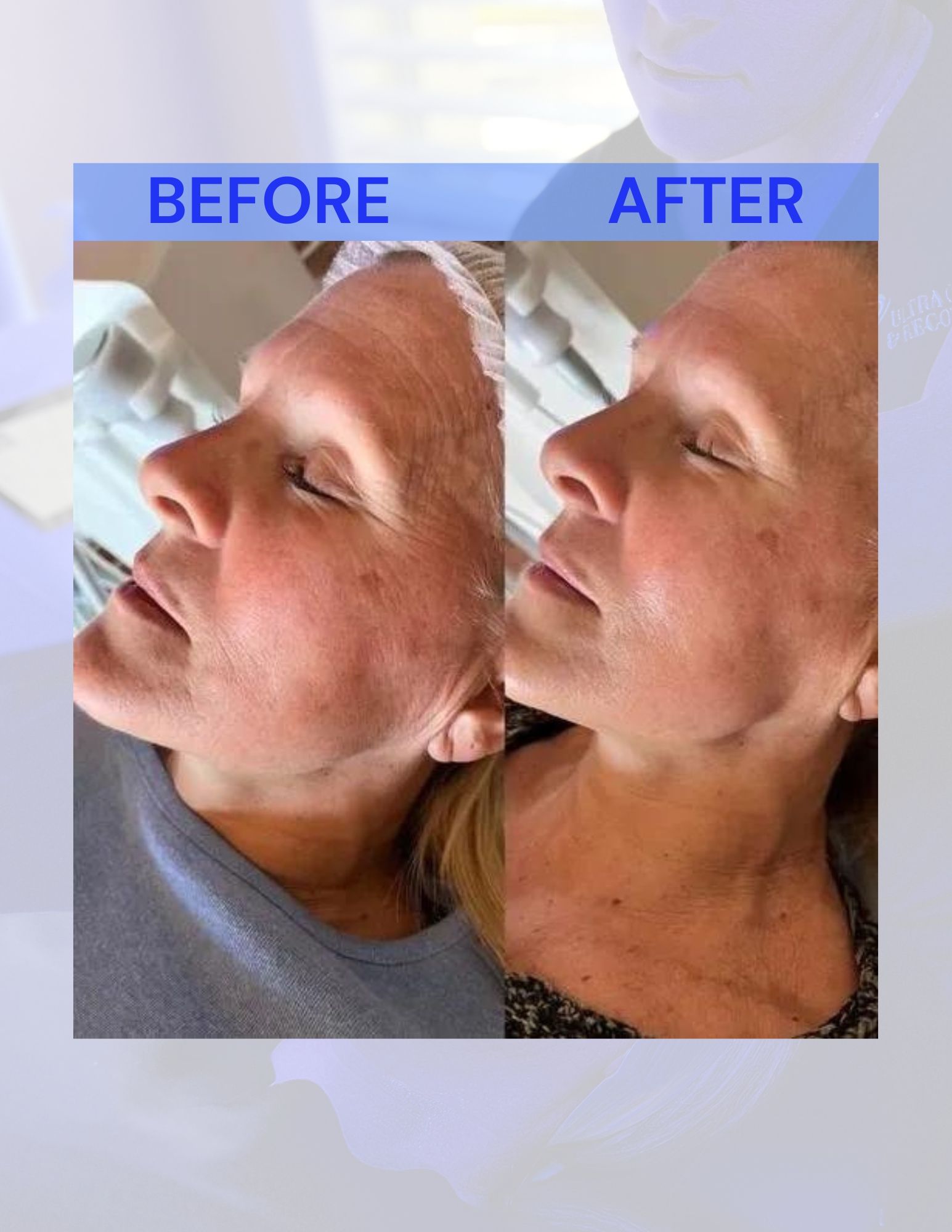 A before and after photo of a woman's face.