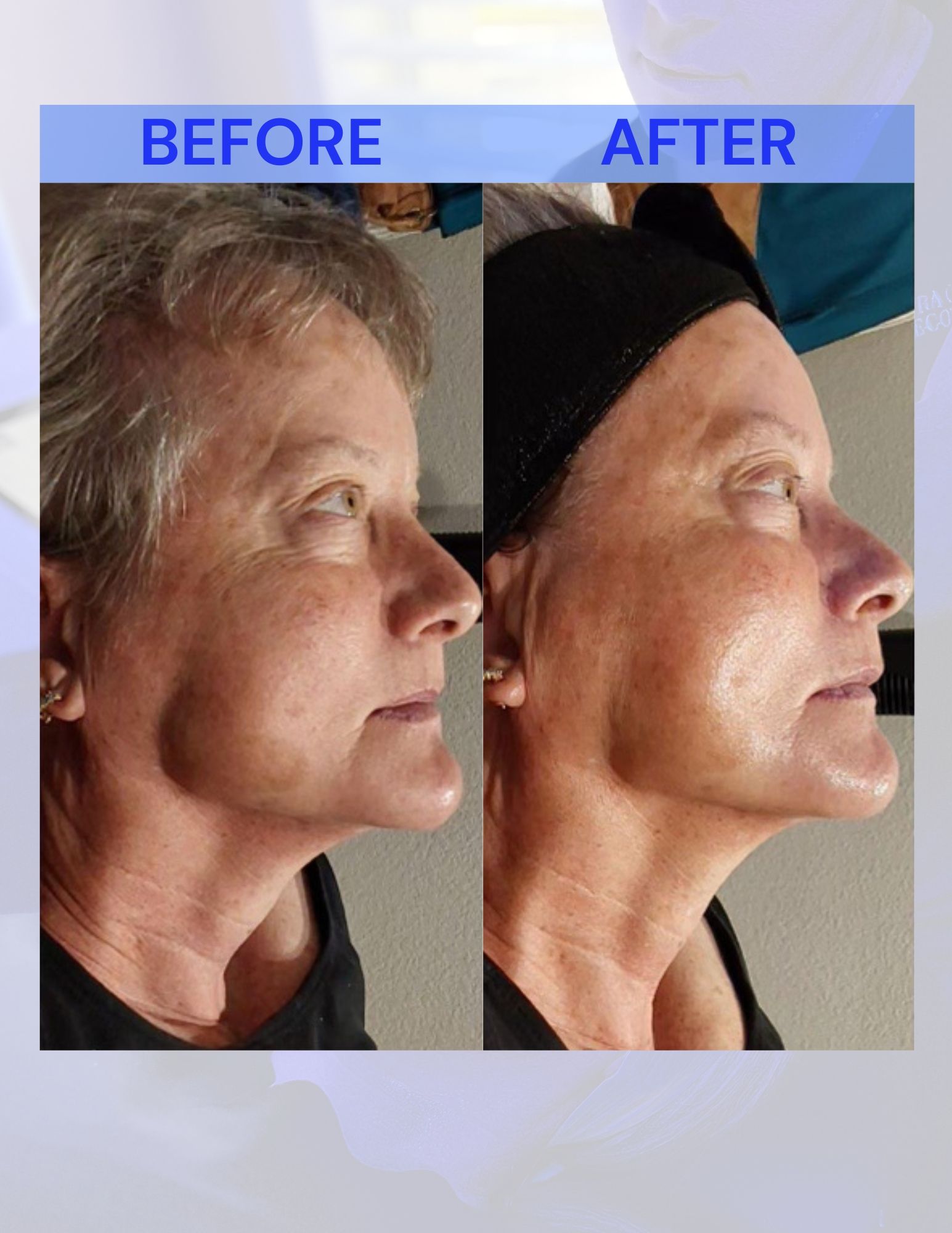 A before and after photo of a woman's face.