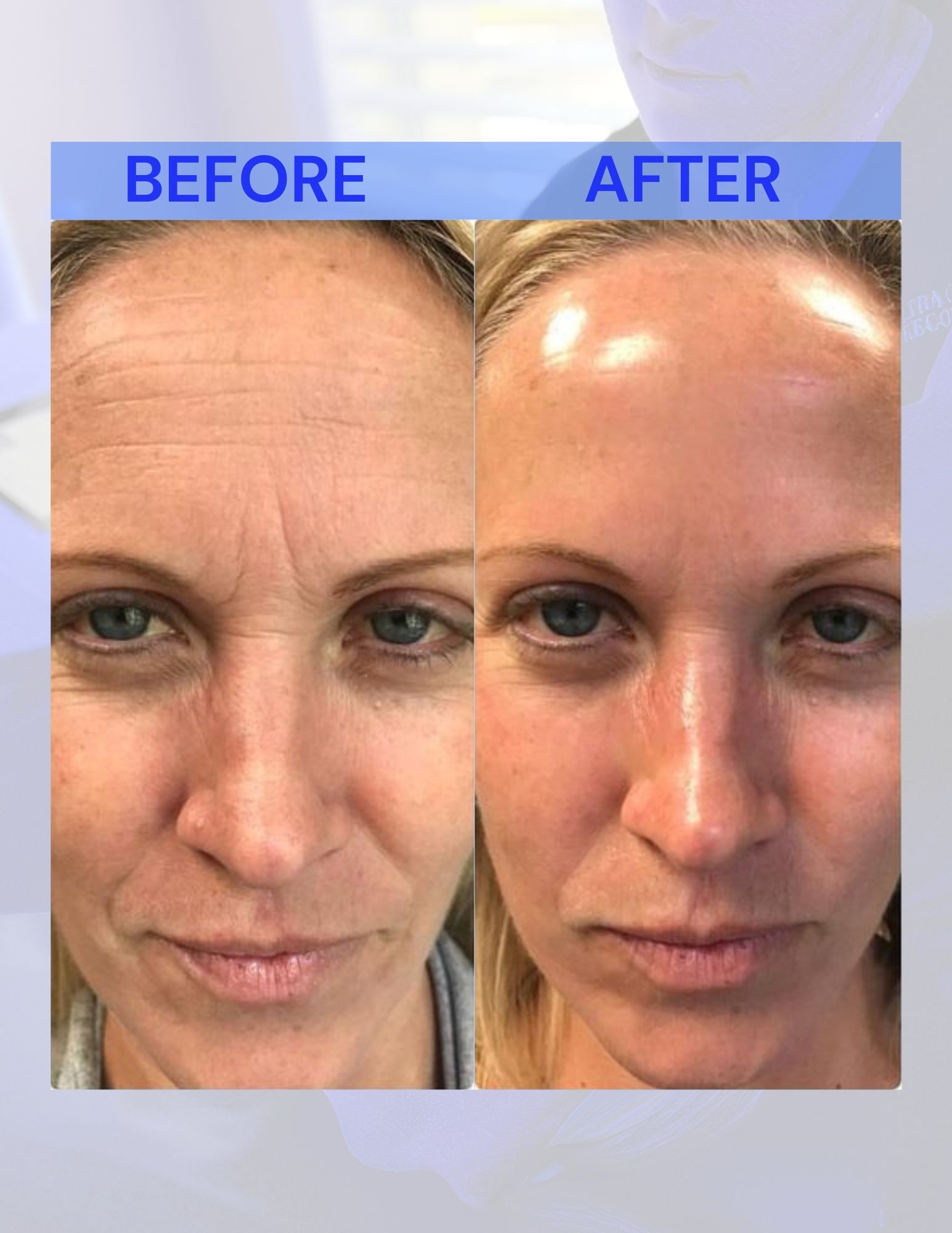 A before and after photo of a woman's face.