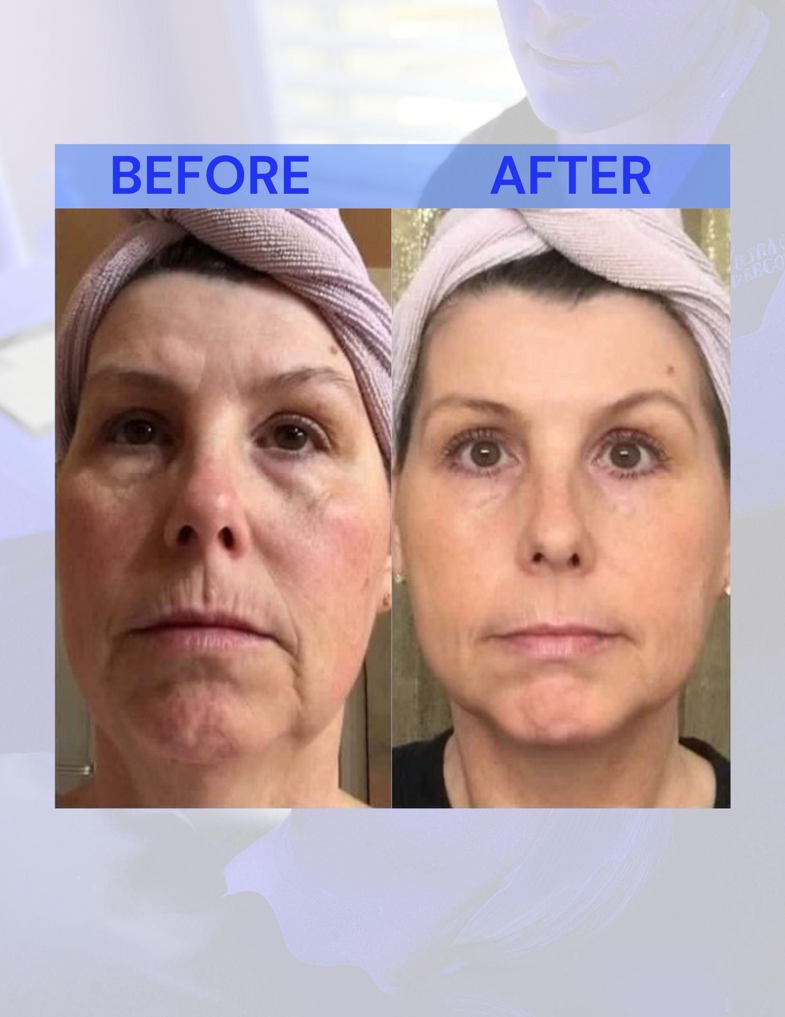 A before and after picture of a woman's face.