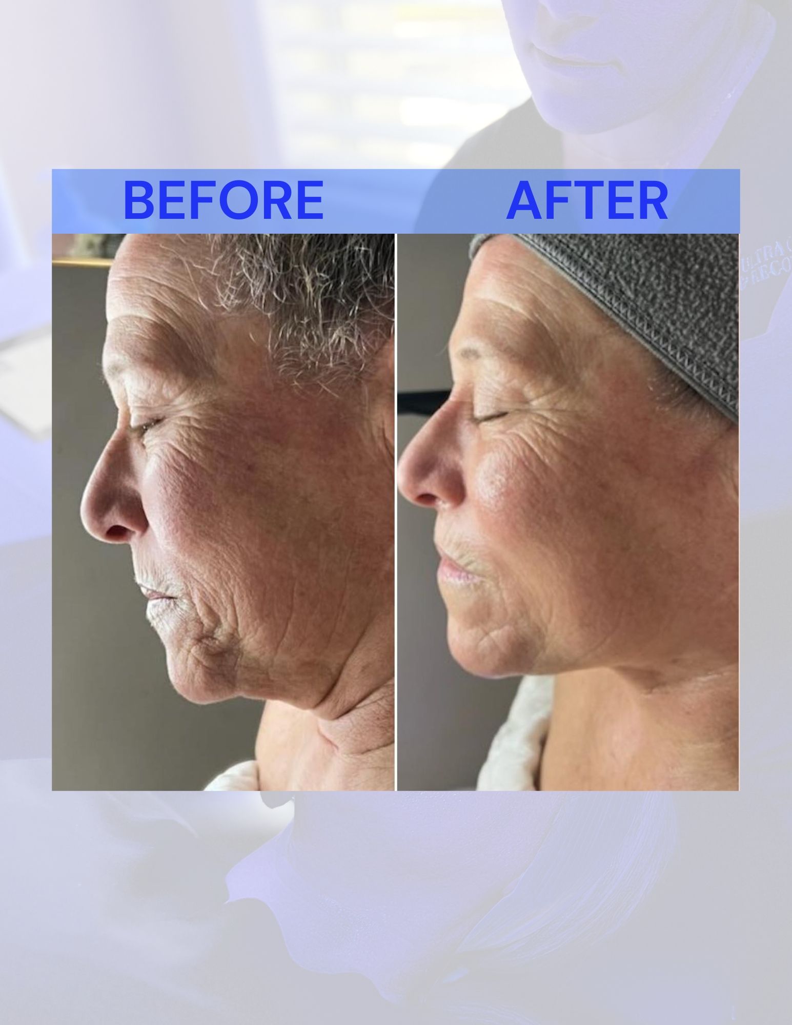 A before and after photo of a woman's face.