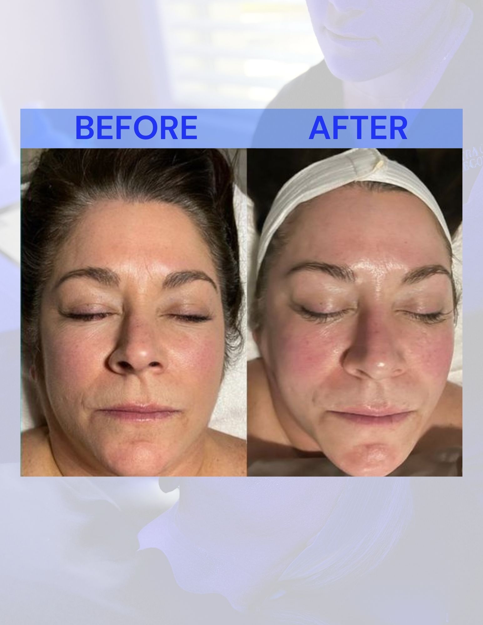 A before and after photo of a woman's face.