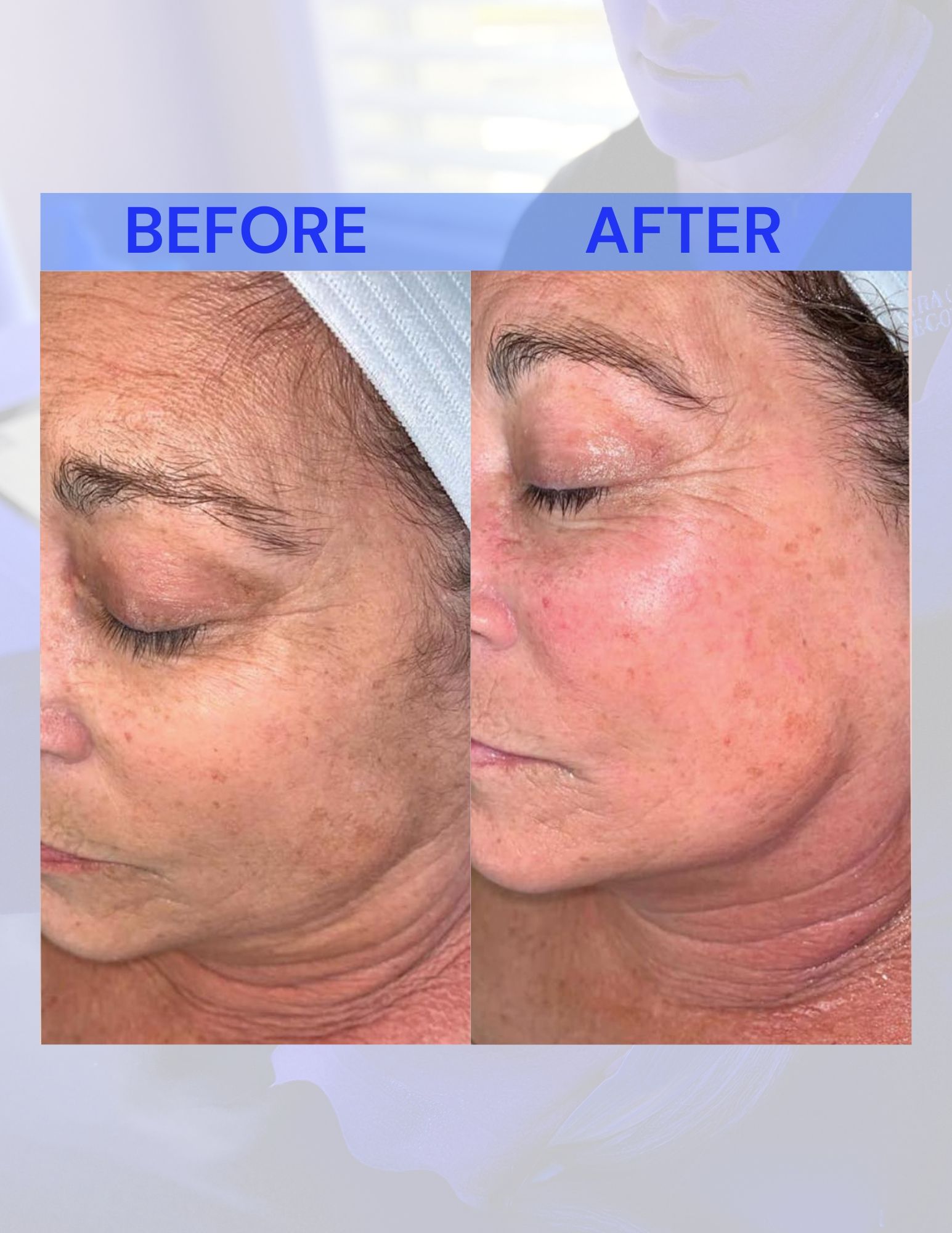 A before and after photo of a woman's face.