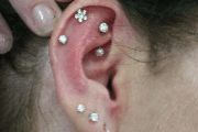 Piercing Services | Dermal Piercings | Salinas, CA Piercing Services | Dermal Piercings | Salinas, CA