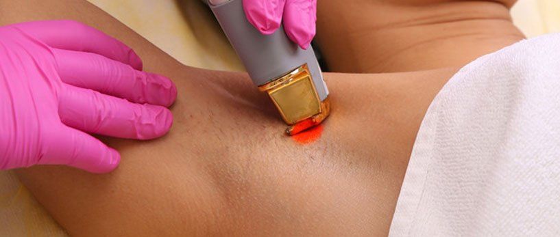 Hair removal treatment