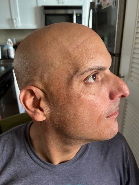 Man with shaved head looking right; indoors.