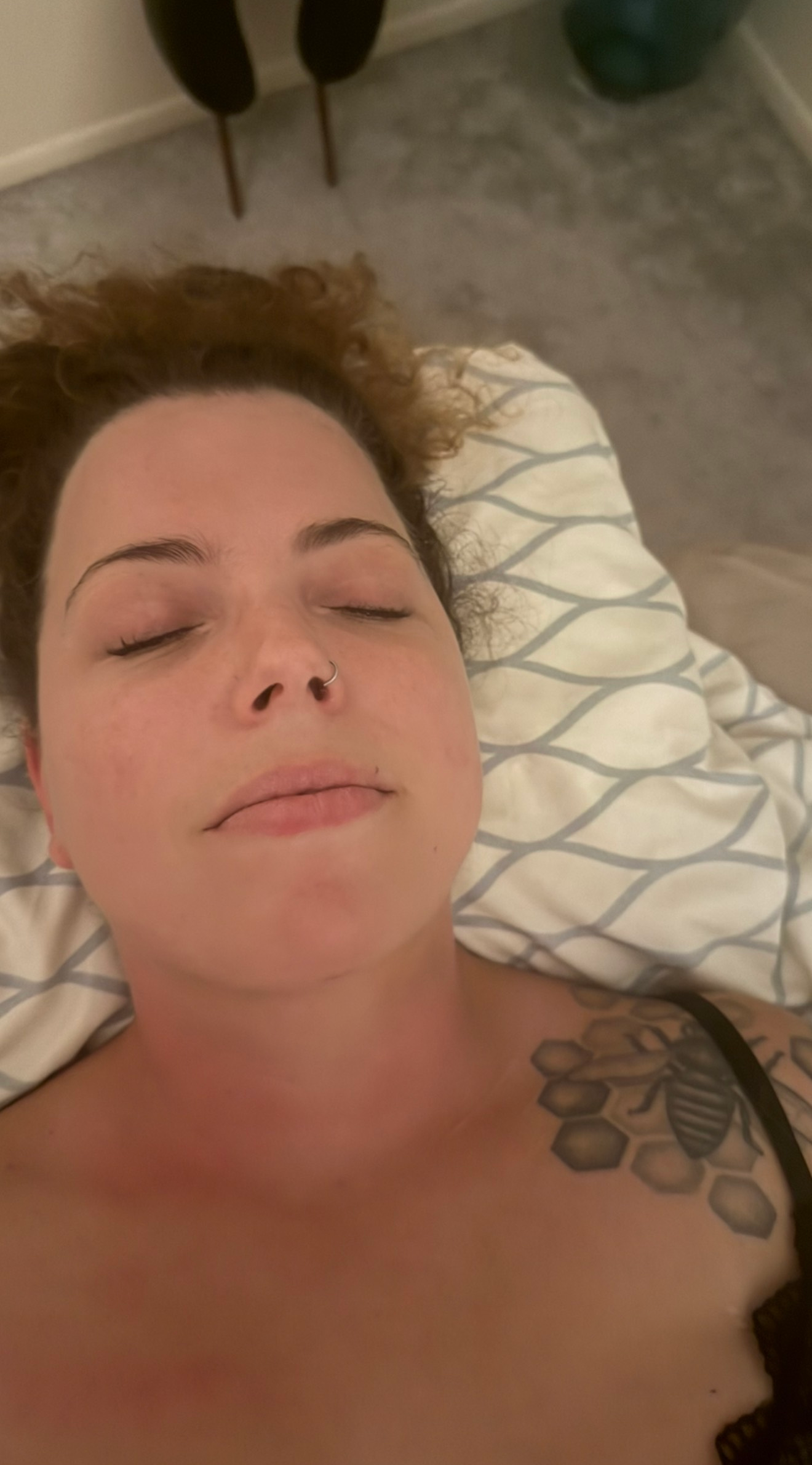 After 30 Year Old woman- Lymphatic Drainage post Chin Liposuction