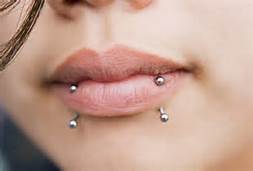 snake bites