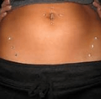 hips