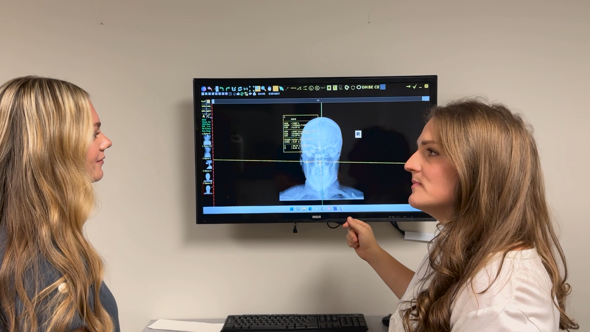 Two women standing by a wall-mounted monitor displaying a 3D head scan
