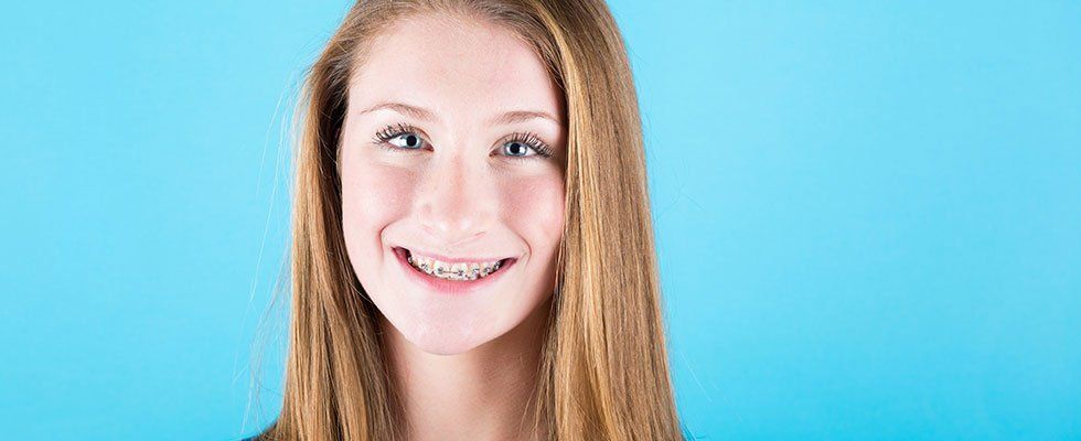 Girl with braces