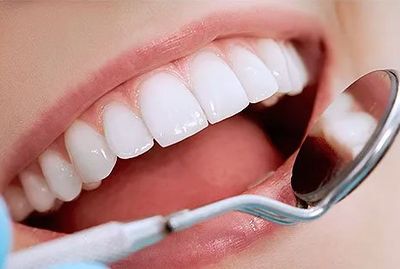 Light Blue Braces - DentaCenter