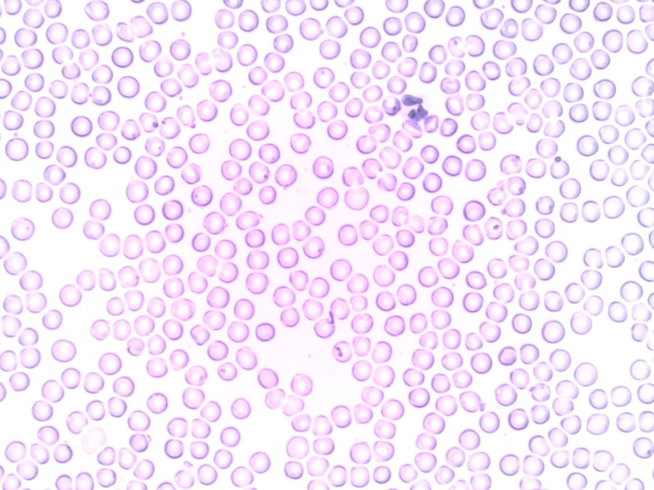 Microscopic view of a slide showing white blood cells, highlighting their role in clinical research