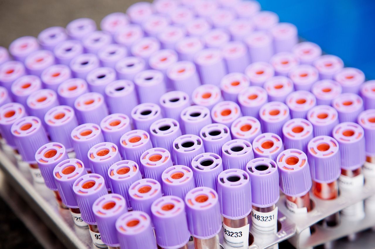 Close-up of violet-capped blood collection tubes, symbolizing precision in blood component isolation