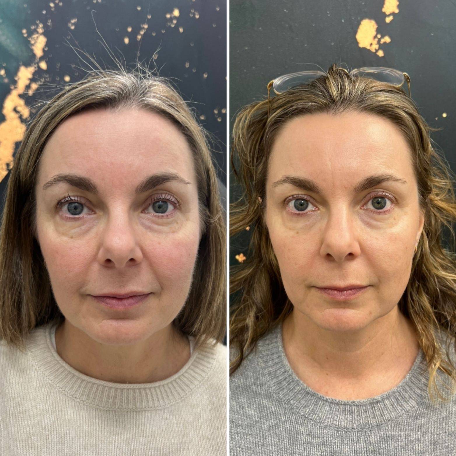 Side-by-side portrait of the same woman before and after makeup, against a dark speckled backdrop.