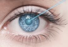Optical service