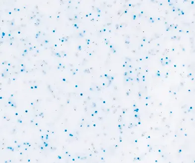 White speckled background with scattered blue dots, like confetti or snowflakes.