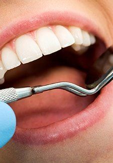 Mercury-free dentistry