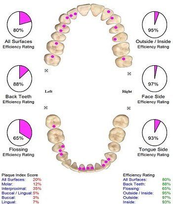 Dental health diagram