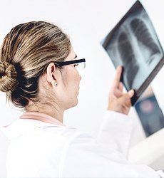 Doctor looking at an x-ray image of a chest