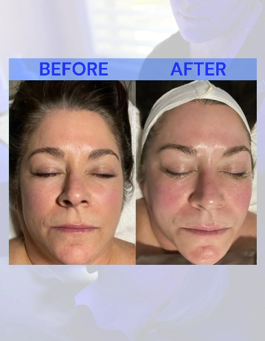 Before and after comparison of a person's face. The 