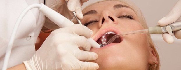 Dental Filling