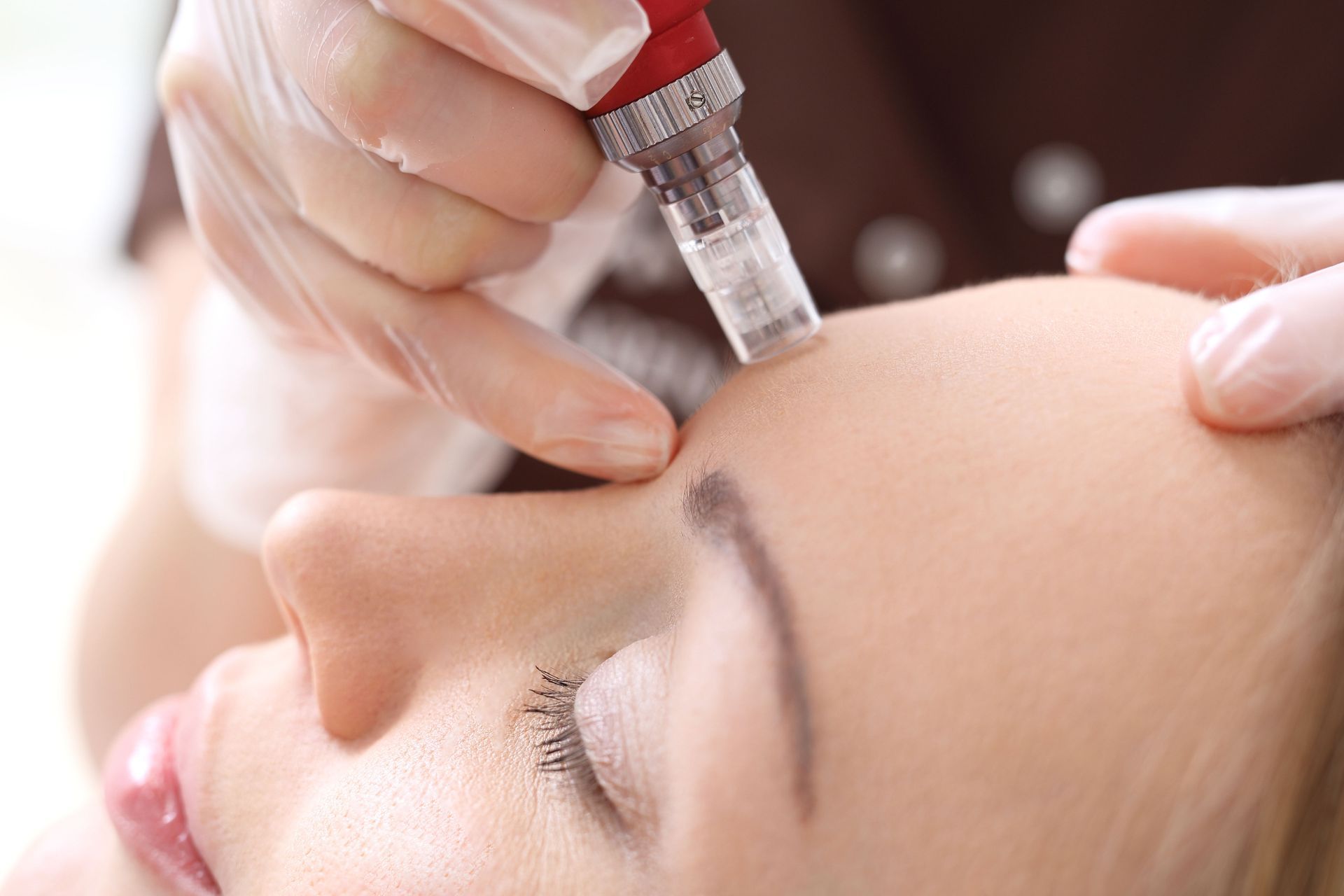 A woman is getting a botox injection in her lips.