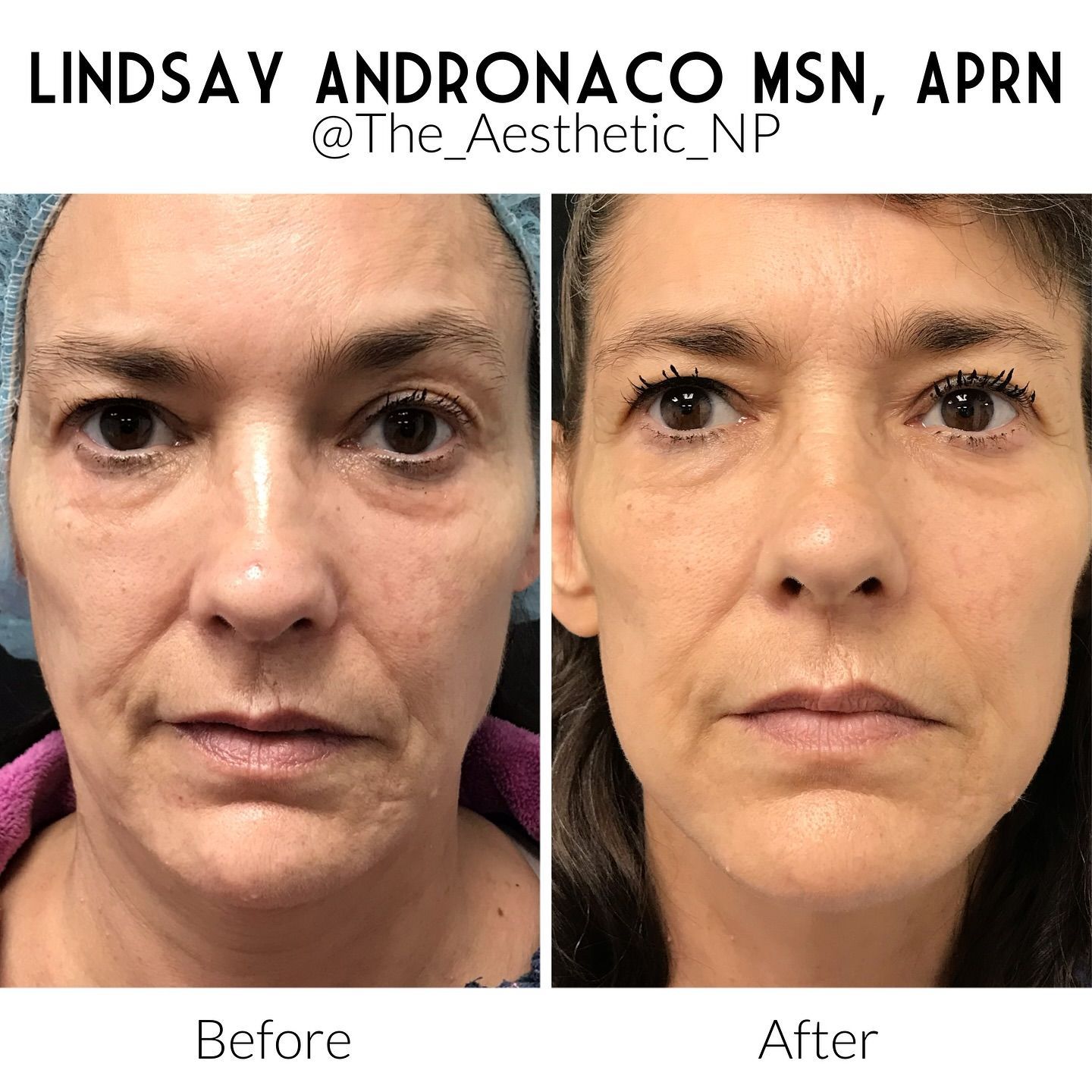 A before and after photo of a woman 's face.