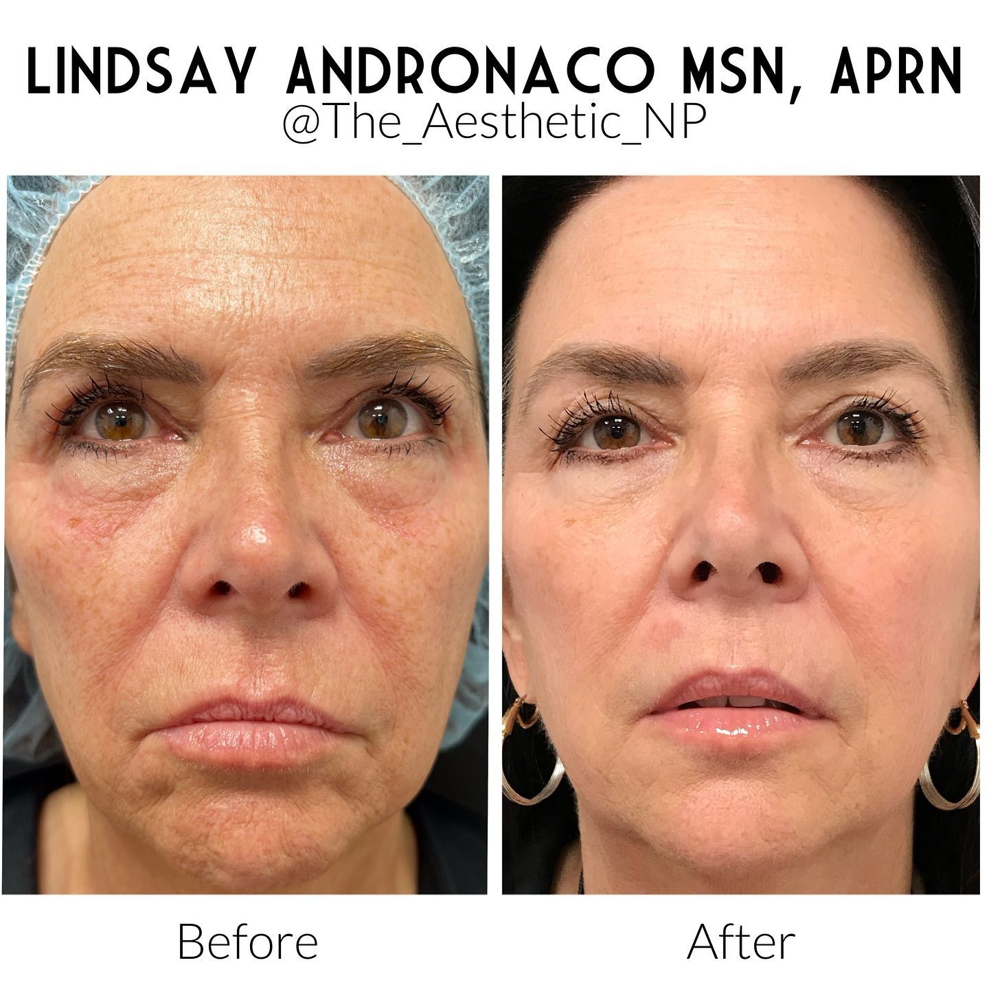 A before and after photo of a woman 's face.