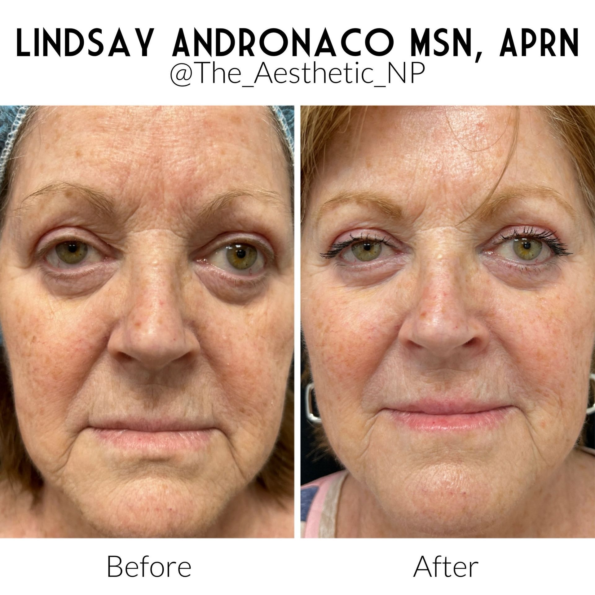 A before and after photo of a woman 's face.