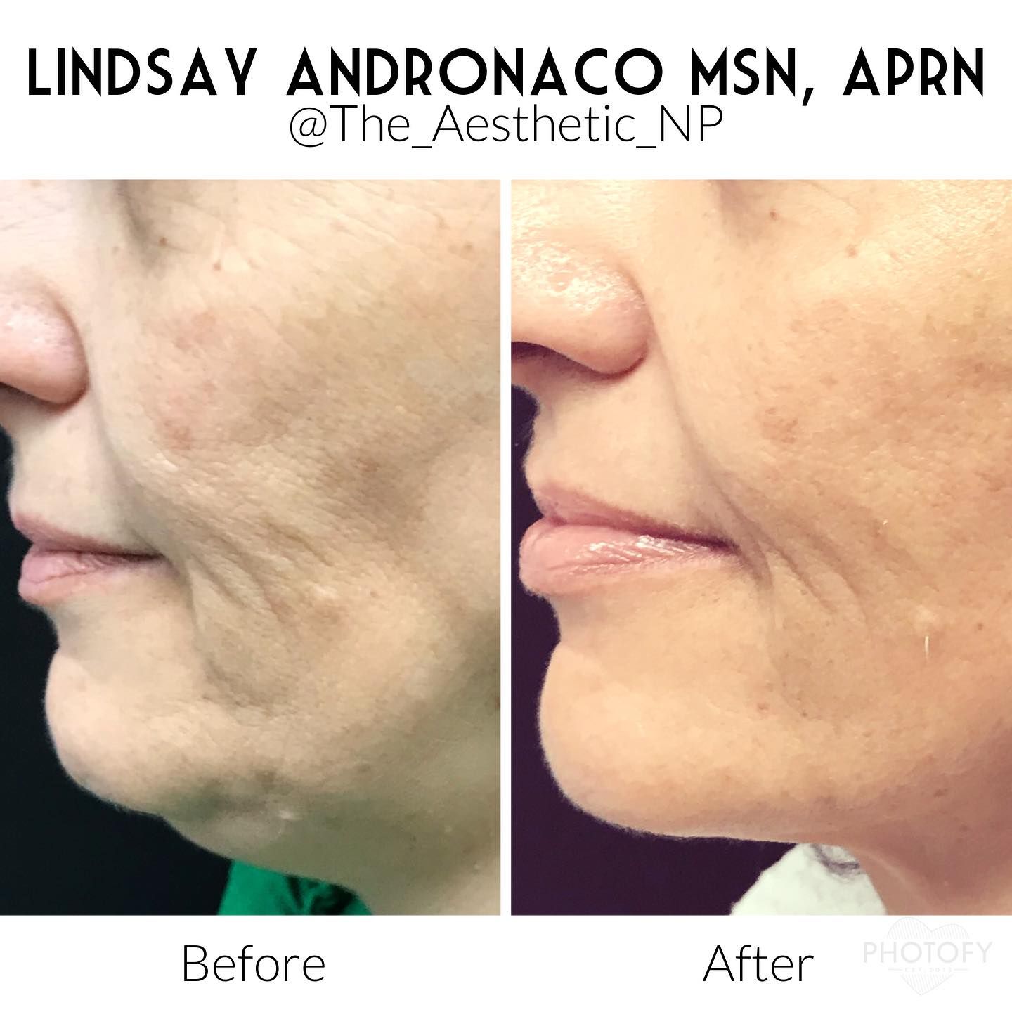 A before and after photo of a woman 's face.