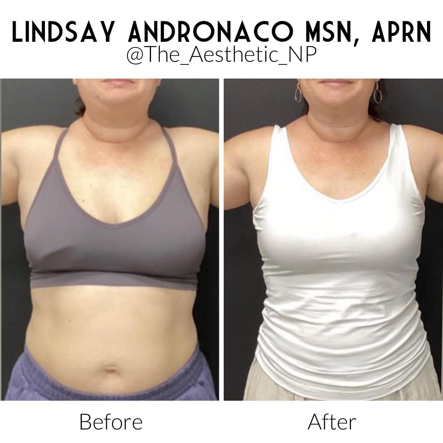 A before and after photo of a woman wearing a white tank top